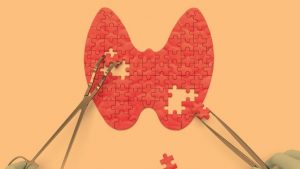 Ipotiroidismo e Alimentazione