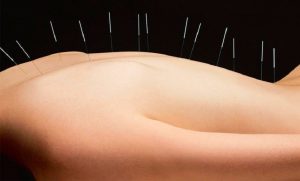 Introduzione all'agopuntura