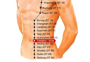 Come curare con l'agopuntura